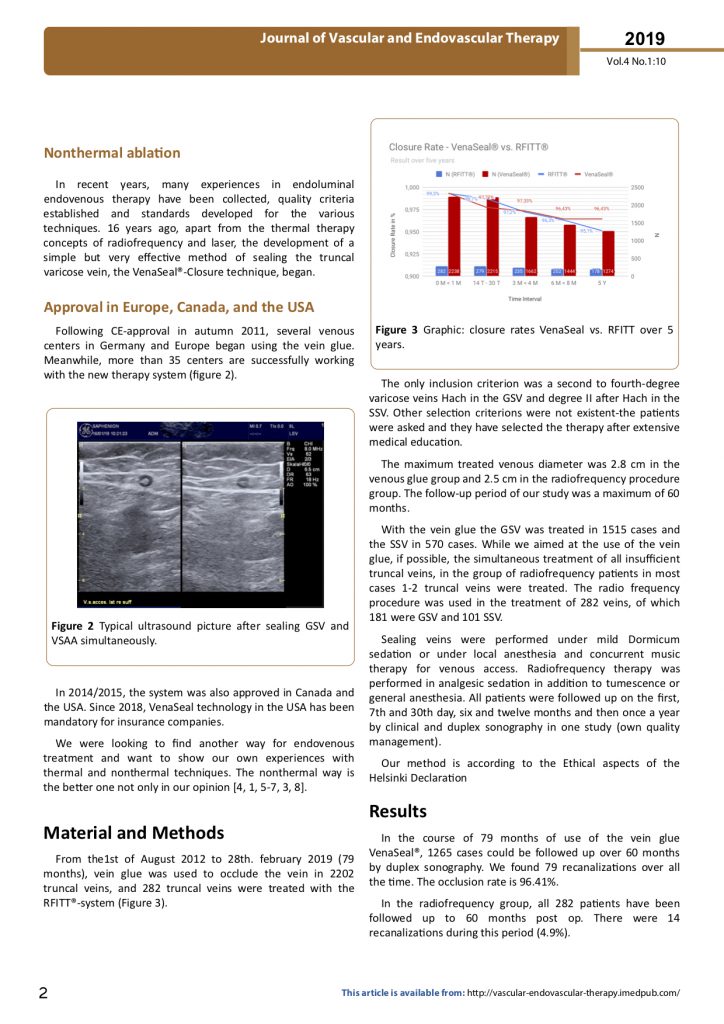 Varicose Vein Laser Treatment